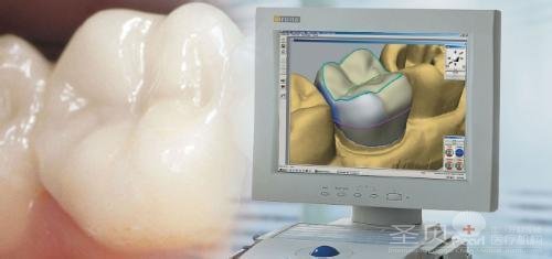 什么是二氧化钴烤瓷牙?