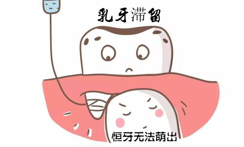 乳牙滞留.jpg
